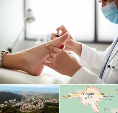 متخصص زخم دیابت در گرگان