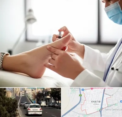 متخصص زخم دیابت در خطیب تبریز 