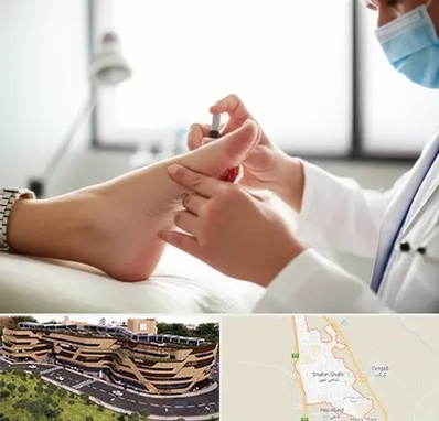 متخصص زخم دیابت در شاهین شهر