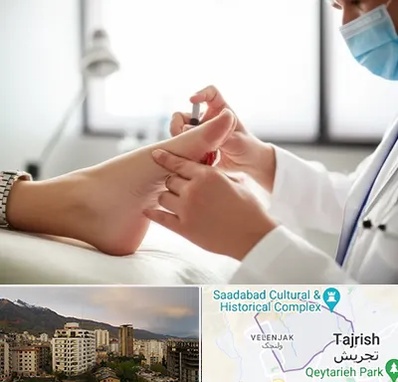 متخصص زخم دیابت در زعفرانیه
