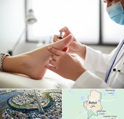 متخصص زخم دیابت در بابل