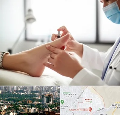 متخصص زخم دیابت در عظیمیه کرج 