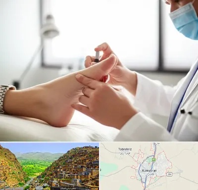 متخصص زخم دیابت در کامیاران