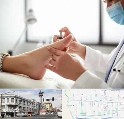 متخصص زخم دیابت در 17شهریور