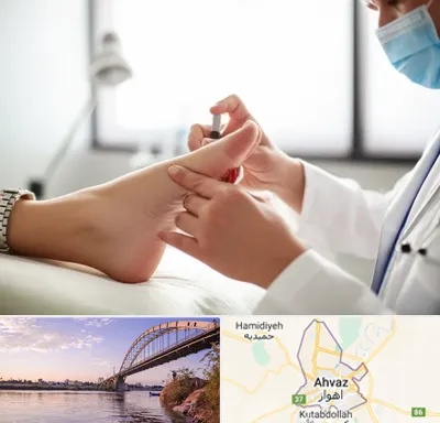 متخصص زخم دیابت در اهواز