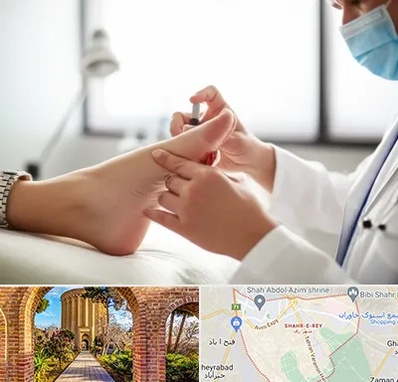 متخصص زخم دیابت در شهر ری