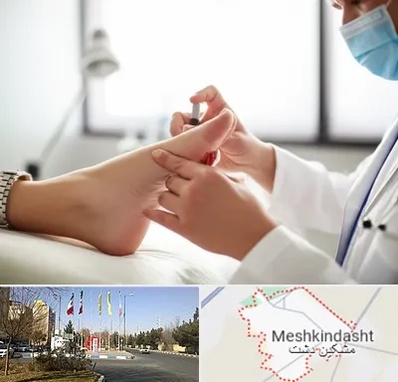 متخصص زخم دیابت در مشکین دشت