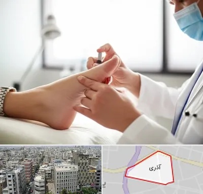 متخصص زخم دیابت در آذری