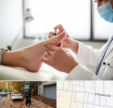 متخصص زخم دیابت در خیابان فلسطین