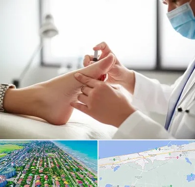 متخصص زخم دیابت در فریدونکنار