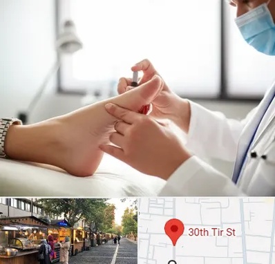 متخصص زخم دیابت در سی تیر