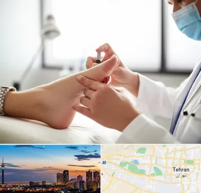 متخصص زخم دیابت در غرب تهران 