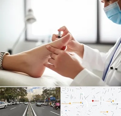 متخصص زخم دیابت در دولت 