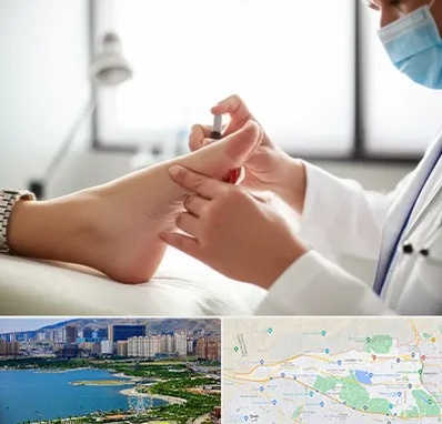 متخصص زخم دیابت در منطقه 22 تهران