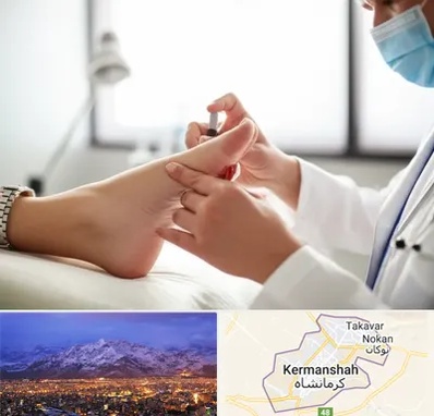 متخصص زخم دیابت در کرمانشاه