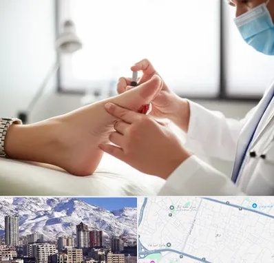 متخصص زخم دیابت در ازگل 