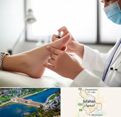 متخصص زخم دیابت در اصفهان