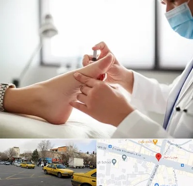 متخصص زخم دیابت در شهناز تبریز 