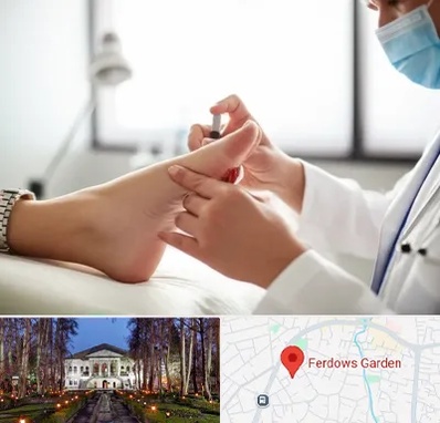 متخصص زخم دیابت در باغ فردوس 