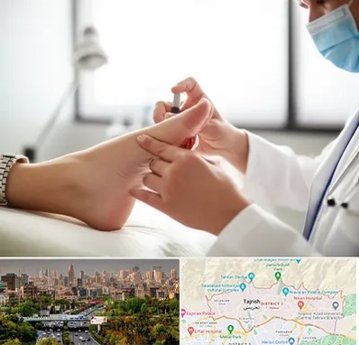 متخصص زخم دیابت در منطقه 1 تهران 