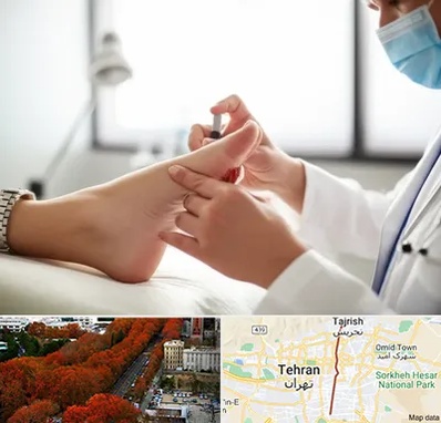 متخصص زخم دیابت در ولیعصر 