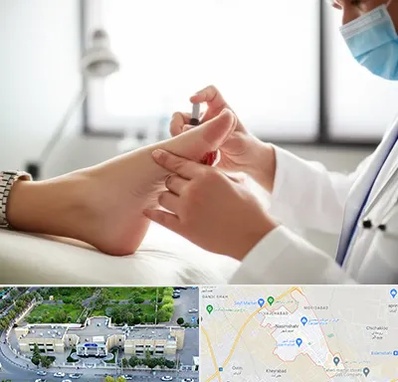 متخصص زخم دیابت در نسیم شهر