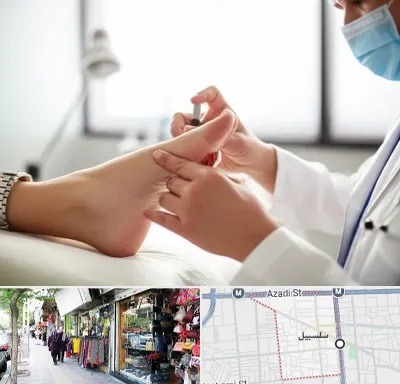 متخصص زخم دیابت در سلسبیل