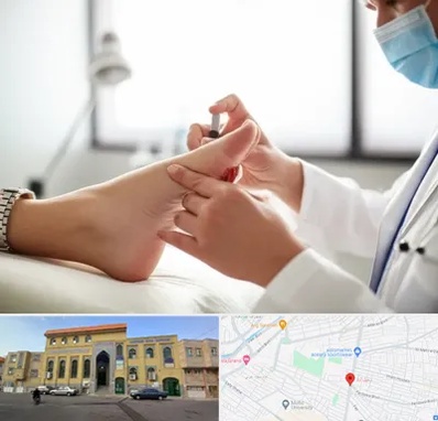 متخصص زخم دیابت در زنبیل آباد قم 