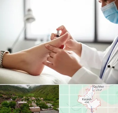 متخصص زخم دیابت در کلاله