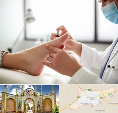 متخصص زخم دیابت در سمنان