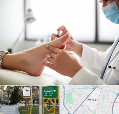 متخصص زخم دیابت در تهران ویلا