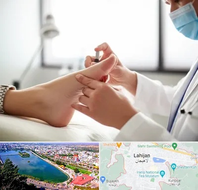متخصص زخم دیابت در لاهیجان