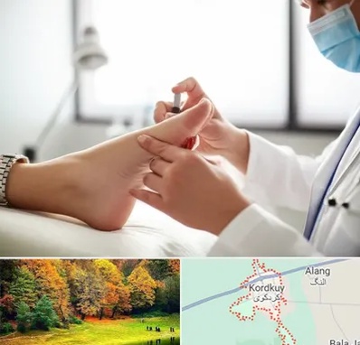 متخصص زخم دیابت در کردکوی