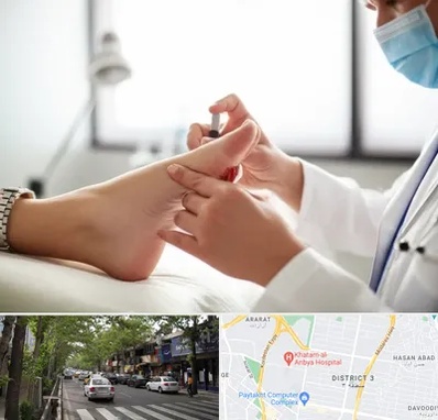 متخصص زخم دیابت در ظفر 