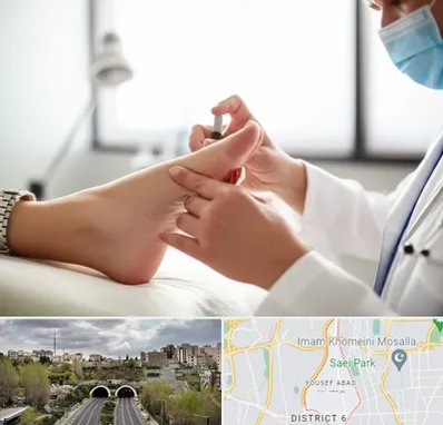 متخصص زخم دیابت در یوسف آباد 