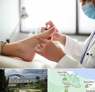 متخصص زخم دیابت در چالوس