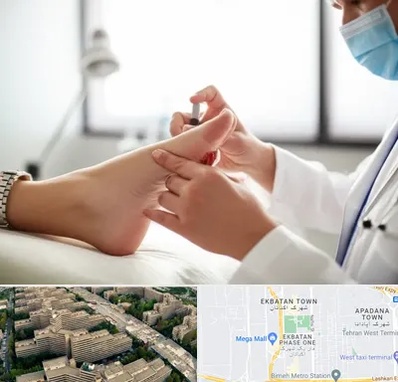 متخصص زخم دیابت در اکباتان 