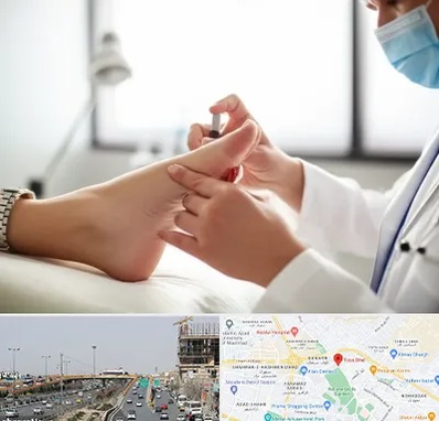 متخصص زخم دیابت در بلوار توس مشهد 