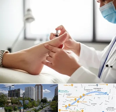 متخصص زخم دیابت در اندرزگو 