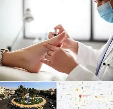 متخصص زخم دیابت در هفت حوض