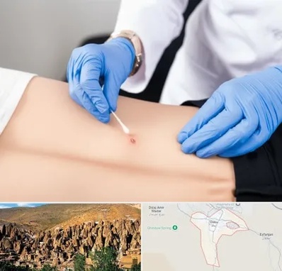 متخصص زخم بستر در اسکو