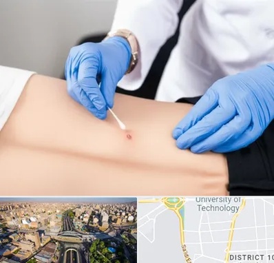 متخصص زخم بستر در استاد معین 