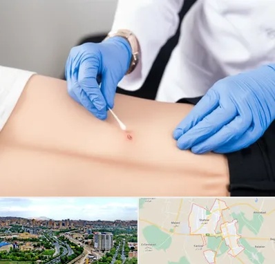 متخصص زخم بستر در شهریار