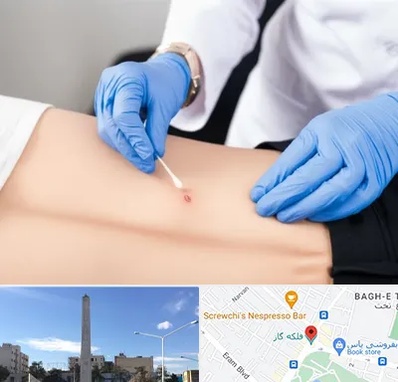 متخصص زخم بستر در فلکه گاز شیراز 