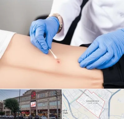 متخصص زخم بستر در قائمیه اسلامشهر 