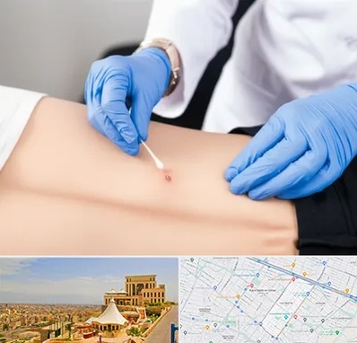 متخصص زخم بستر در هاشمیه مشهد 