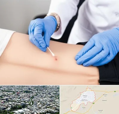 متخصص زخم بستر در شاهرود