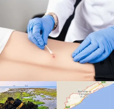 متخصص زخم بستر در بندرلنگه