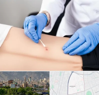 متخصص زخم بستر در جمشیدیه 