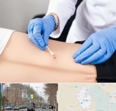 متخصص زخم بستر در نظرآباد کرج 